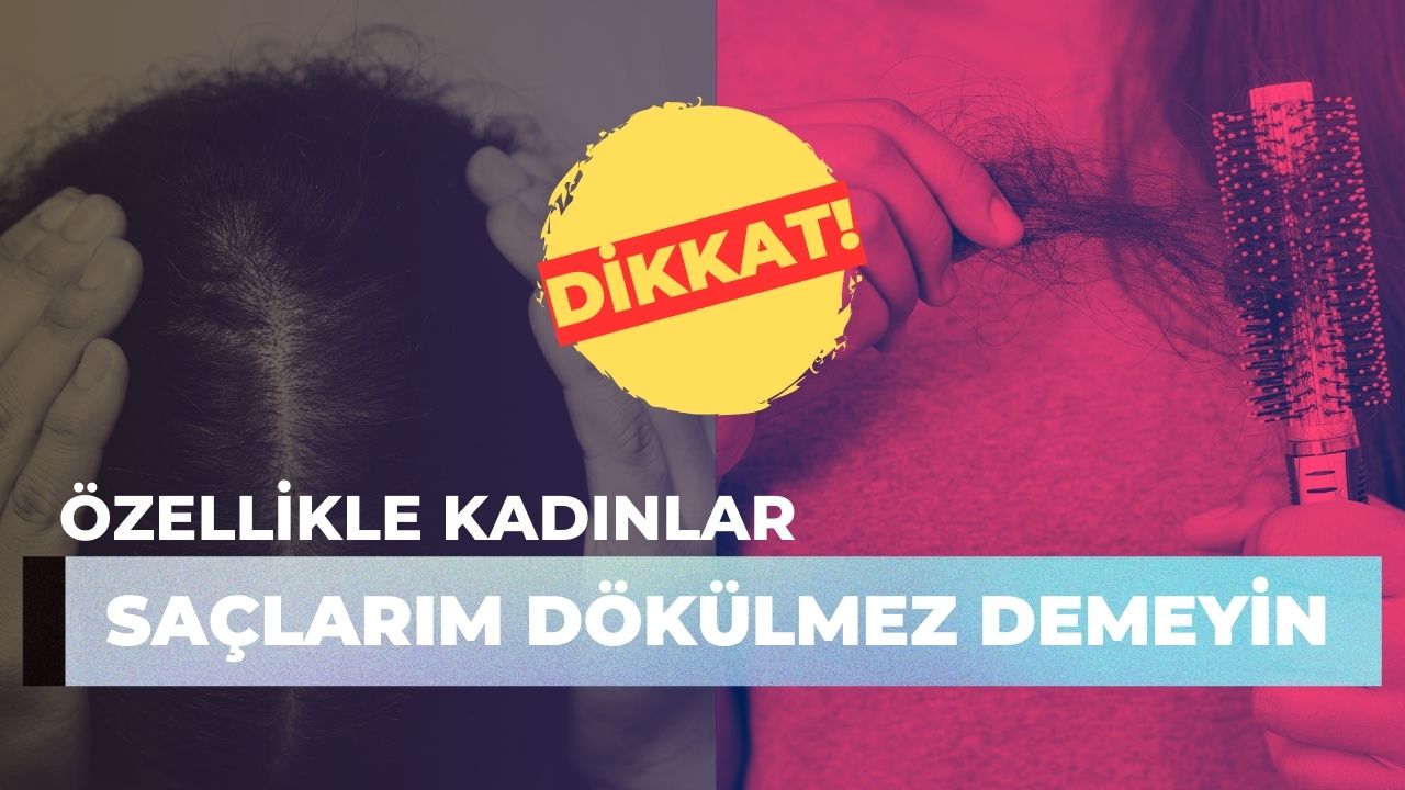 SAÇ DÖKÜLMESİ KADINLARDA DA ERKEKLER KADAR YAYGIN!