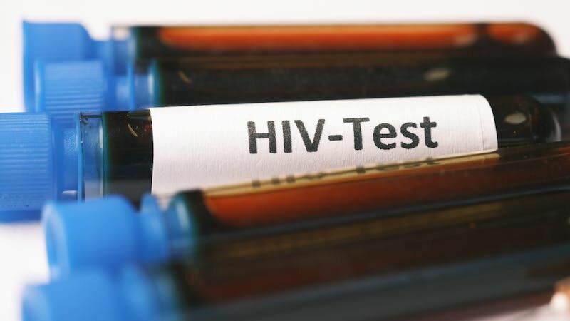 hıv test