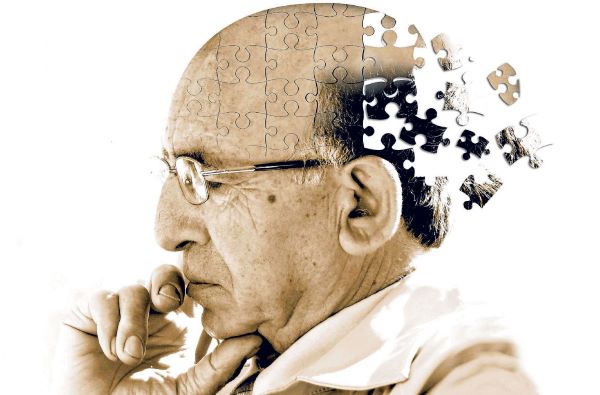 Alzheimerın Yeni Belirtisi Ne Alzheimer Nasıl Anlaşılır11 (1)