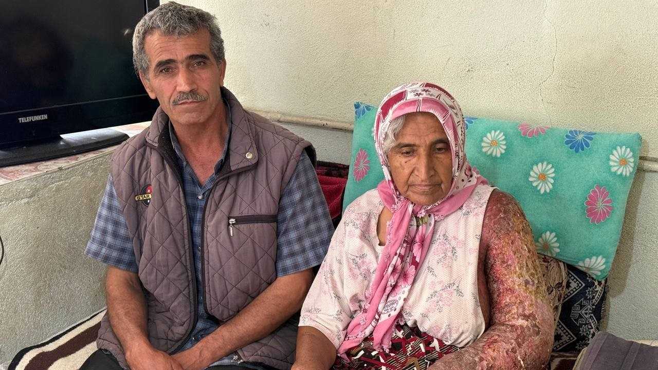 Adana’da Talihsiz Kadına 8 Yıldır Tanı Konamıyor2