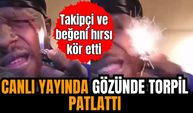 Canlı yayında gözünde torpil patlattı