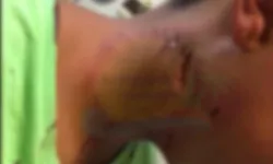 Antalya'da sahipli köpek bir çocuğun boğazını parçaladı