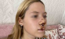 Lise öğrencisi kızın suratına taş atıp dişlerini döken gencin yargılanmasına başlanıldı