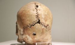 Dünyanın ilk beyin ameliyatına ait kafatası 10 bin yaşında