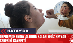 Hatay'da Depremde Enkaz Altında Kalan Yeliz Seyyar Çenesini Kaybetti