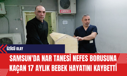 Samsun'da Nar Tanesi Nefes Borusuna Kaçan 17 Aylık Bebek Hayatını Kaybetti