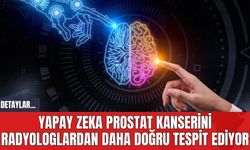 Yapay Zeka Prostat Kanserini Radyologlardan Daha Doğru Tespit Ediyor