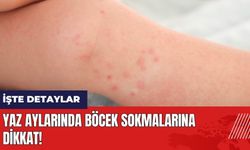 Yaz aylarında böcek sokmalarına dikkat!