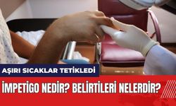 Aşırı sıcaklar cilt hastalıklarını tetikledi! İmpetigo nedir? Belirtileri nelerdir?