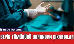 Beyin Tümörünü Burundan Çıkardılar