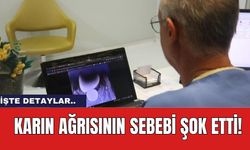 Karın Ağrısının Sebebi Şok Etti!