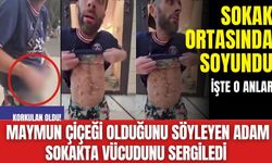 Korkulan oldu! Maymun çiçeği olduğunu söyleyen adam sokakta vücudunu sergiledi