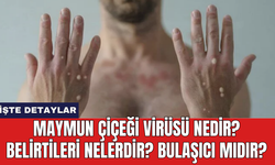 Maymun Çiçeği Virüsü Nedir? Belirtileri Nelerdir? Bulaşıcı Mıdır?