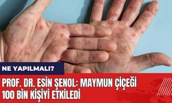 Prof. Dr. Esin Şenol: Maymun Çiçeği 100 bin kişiyi etkiledi