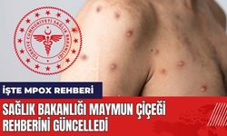 Sağlık Bakanlığı'ndan Maymun Çiçeği rehberi