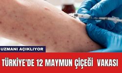 Türkiye'de 12 maymun çiçeği vakası