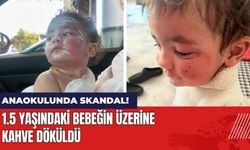 Anaokulunda 1.5 Yaşındaki Bebeğin Üzerine Kahve Döküldü