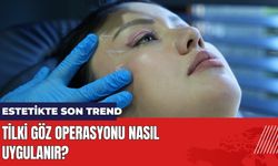 Estetikte Son Trend: Tilki Göz Operasyonu