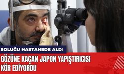 Gözüne Kaçan Japon Yapıştırıcısı Kör Ediyordu