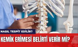 Kemik Erimesi Belirti Verir Mi? Nasıl Tespit Edilir?