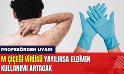 M Çiçeği Virüsü Yayılırsa Eldiven Kullanımı Artacak