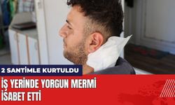 Yorgun Mermi İsabet Etti: 2 Santimle Kurtuldu