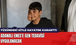 Adanalı Enes'e Gen Tedavisi Uygulanacak