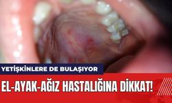 El-Ayak-Ağız Hastalığına Dikkat! Yetişkinlere de Bulaşıyor