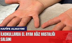 İlkokullarda El Ayak Ağız Hastalığı Salgını!