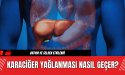 Karaciğer Yağlanması Nasıl Geçer?