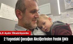 2 Yaşındaki Çocuğun Akciğerinden Fındık Çıktı