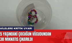 5 yaşındaki Çocuğun Vücudundan 38 Mıknatıs Çıkarıldı