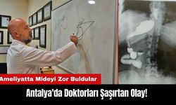 Antalya'da Doktorları Şaşırtan Olay! Ameliyatta Mideyi Zor Buldular