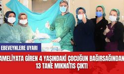 Ameliyata Giren 4 Yaşındaki Çocuğun Bağırsağından 13 Tane Mıknatıs Çıktı