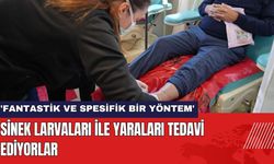 Sinek Larvaları ile Yaraları Tedavi Ediyorlar