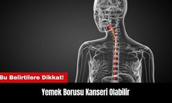 Bu Belirtilere Dikkat! Yemek Borusu Kanseri Olabilir