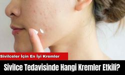 Sivilce Tedavisinde Hangi Kremler Etkili? Sivilceler İçin En İyi Kremler