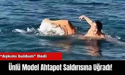 Ünlü Model Ahtapot Saldırısına Uğradı!