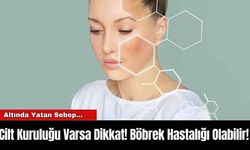 Cilt Kuruluğu Varsa Dikkat! Böbrek Hastalığı Olabilir!