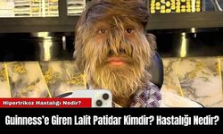 Guinness’e Giren Lalit Patidar Kimdir? Hastalığı Nedir?