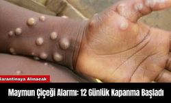 Maymun Çiçeği Alarmı: 12 Günlük Kapanma Başladı