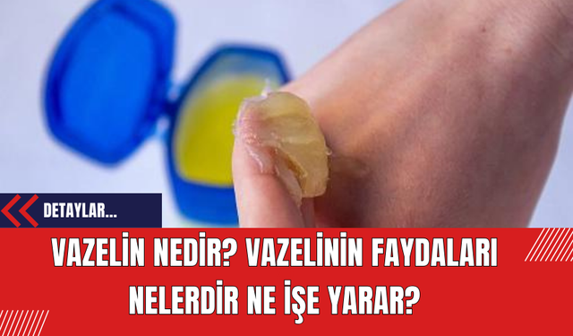 Vazelin Nedir? Vazelinin Faydaları Nelerdir Ne İşe Yarar?