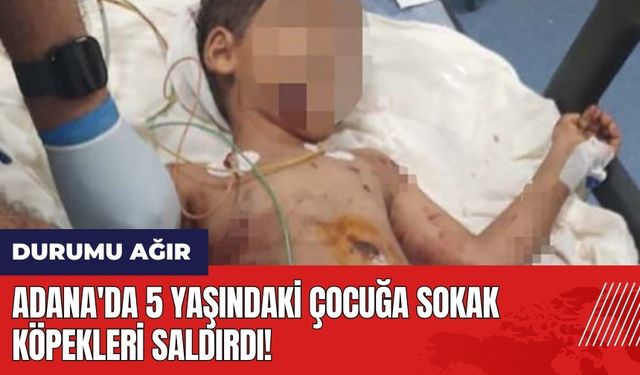 Adana'da 5 yaşındaki çocuğa sokak köpekleri saldırdı! Durumu ağır