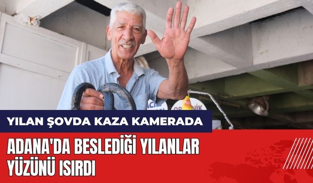 Adana'da beslediği yılanlar yüzünü ısırdı