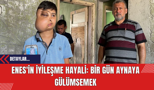 Enes'in İyileşme Hayali: Bir Gün Aynaya Gülümsemek