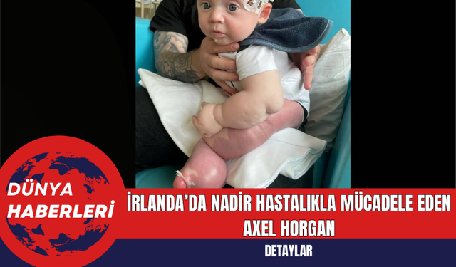 İrlanda’da Nadir Hastalıkla Mücadele Eden Axel Horgan