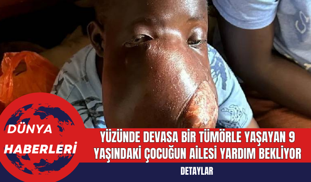 Yüzünde Devasa Bir Tümörle Yaşayan 9 Yaşındaki Çocuğun Ailesi Yardım Bekliyor