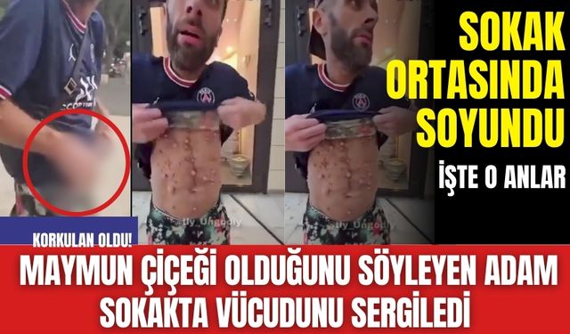 Korkulan oldu! Maymun çiçeği olduğunu söyleyen adam sokakta vücudunu sergiledi