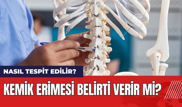 Kemik Erimesi Belirti Verir Mi? Nasıl Tespit Edilir?