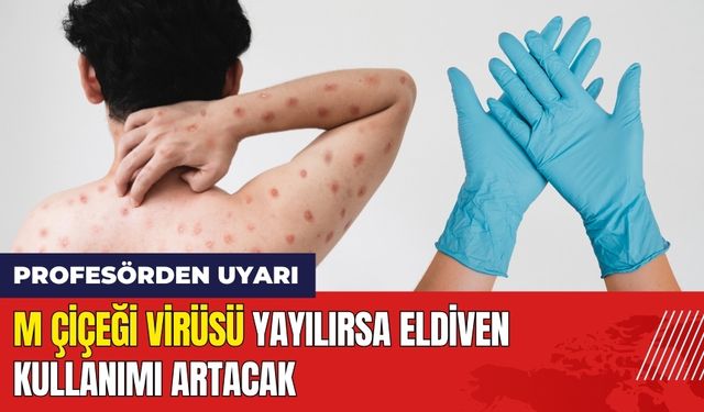 M Çiçeği Virüsü Yayılırsa Eldiven Kullanımı Artacak